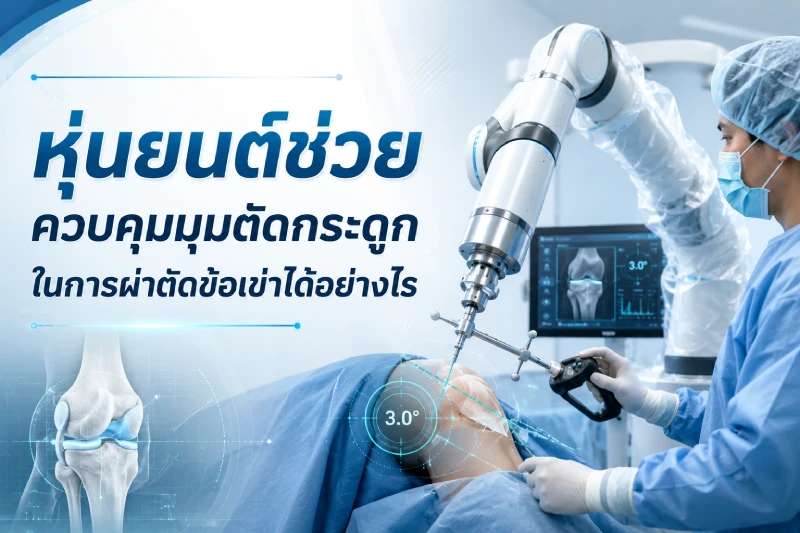 หุ่นยนต์ช่วยควบคุมมุมตัดกระดูกในการผ่าตัดข้อเข่าได้อย่างไร